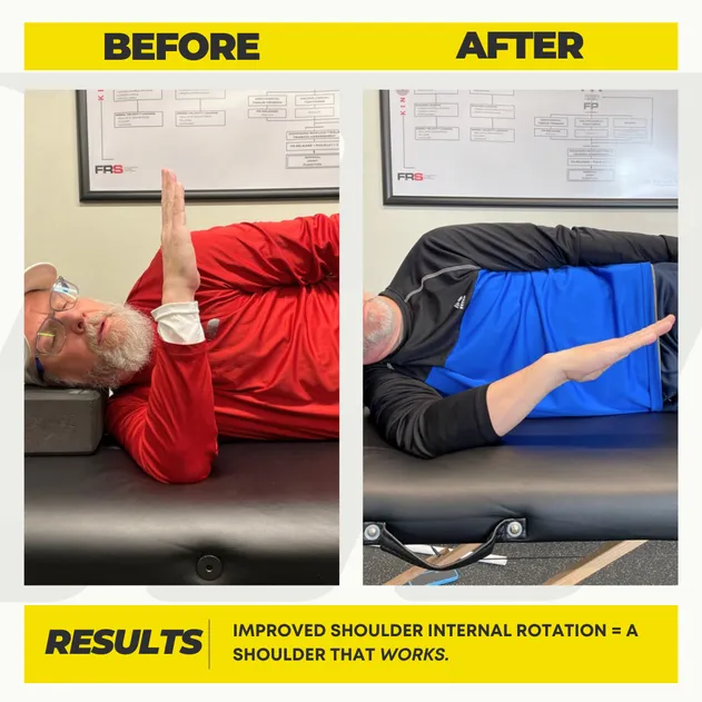 Jay's before and after showing increased shoulder range of motion and less pain through FRC at Motive Training